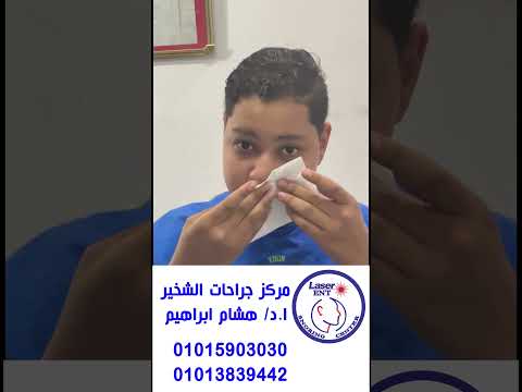 مشاكل الحاجز الانفي مالهومش سن ا ادهم 15 سنه بسبب النزيف عمل عملية حاجز انفي و لحمية كبيرة جدا