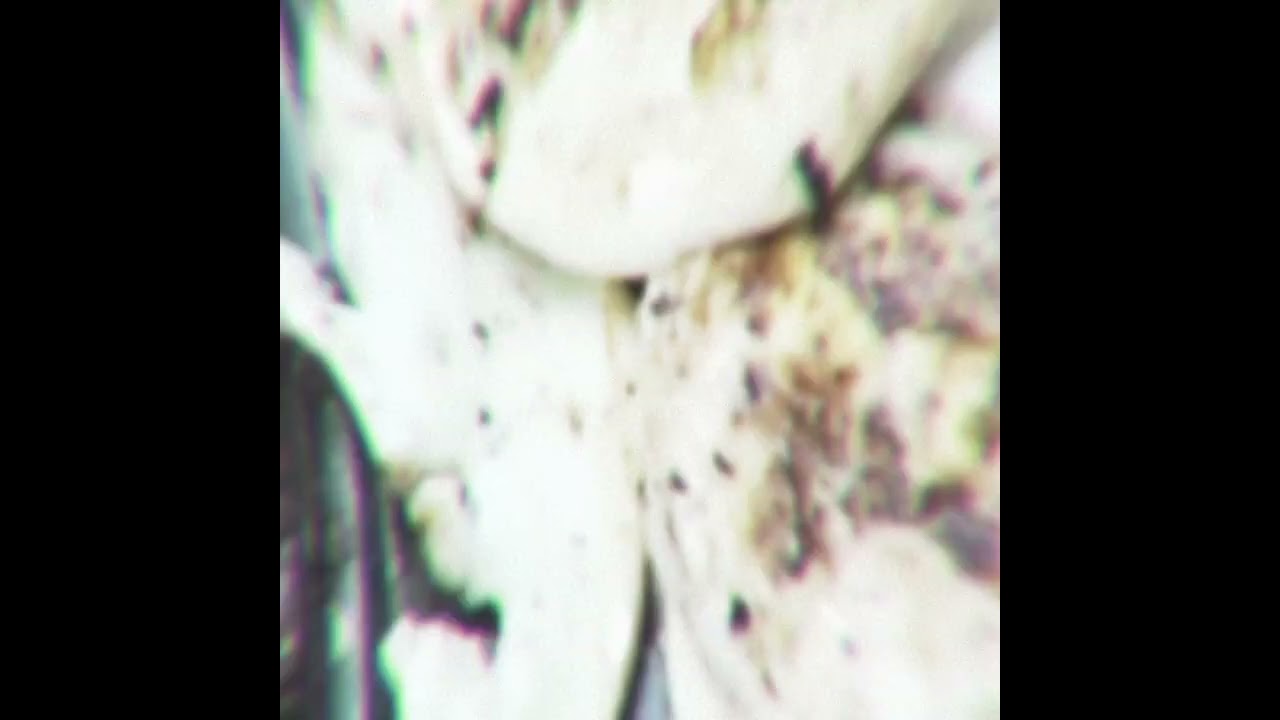 eell1ot - Stomach Of Bugs (Official Music Video)