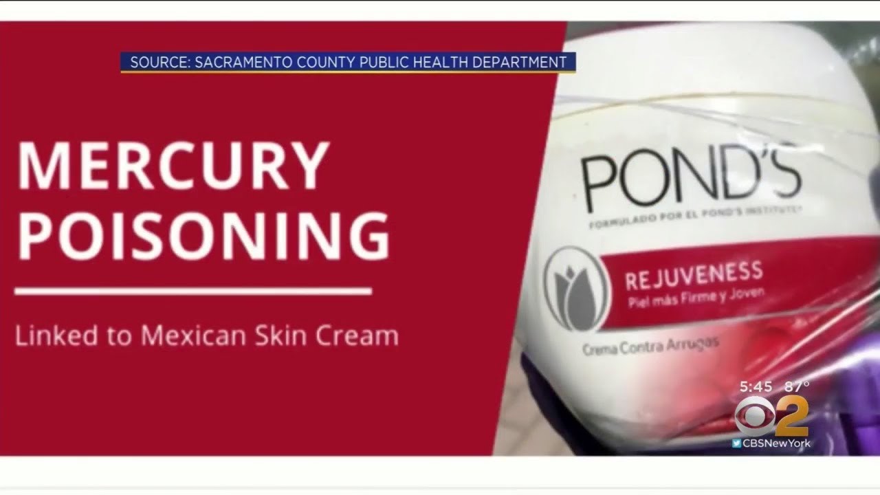 cbs new york weather Skin Cream From Mexico Causing Mercury Poisoning
