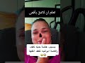 فنانة تخسر انفها بسبب لدغة افعى