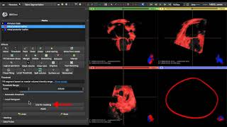 Workflow Demo for Mitral Annular Modeling and Segmentation in SlicerHeart Extension for 3D Slicer