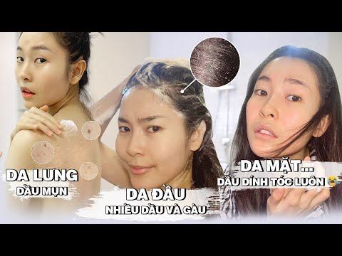 Kiềm dầu từ đầu đến chân ❗ Làm gì khi DA ĐẦU , TÓC và DA MẶT tiết dầu quá nhiều ❓ GIVEAWAY❤