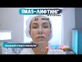 Smas-лифтинг на ULTRAFORMER | Реальный результат и отзыв о процедуре