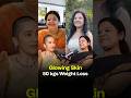 How to Achieve Clear Skin After Weight Loss | No Carbs Diet | Indian Weight Loss Diet by Richa