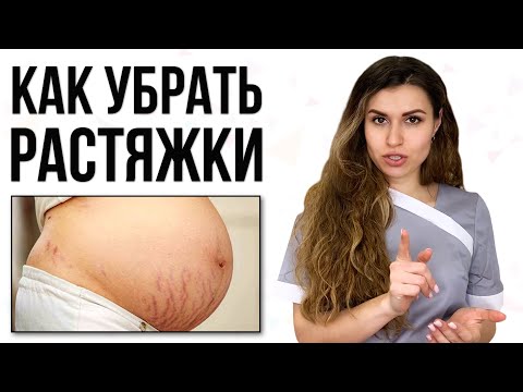 Как убрать растяжки и стрии на теле / Эффективные процедуры