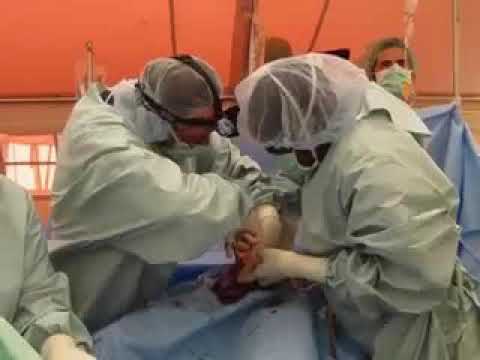 Dr. Dave David performs emergency C Section in Haiti after 2010 major earthquake
