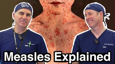 Get The Measles Vaccine Or Risk These Very Serious Complications Including Death