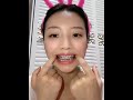 牙套美女口腔牙齒檢查 牙套美女口腔牙齒檢查