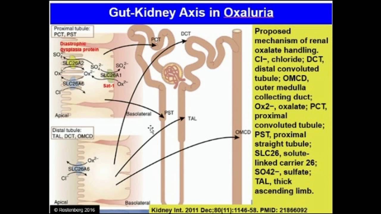 The Down Side to High Oxalates Problems with Sulfate, B6, Gut and