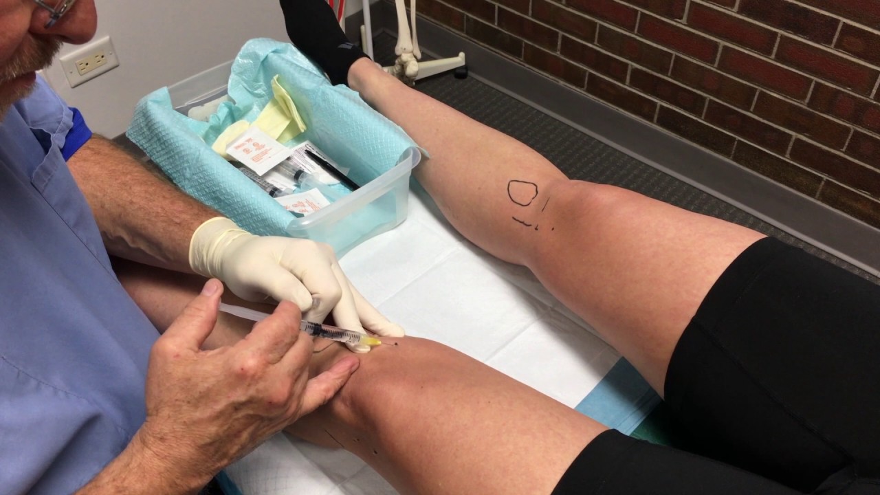 An Introduction into Knee Prolotherapy YouTube