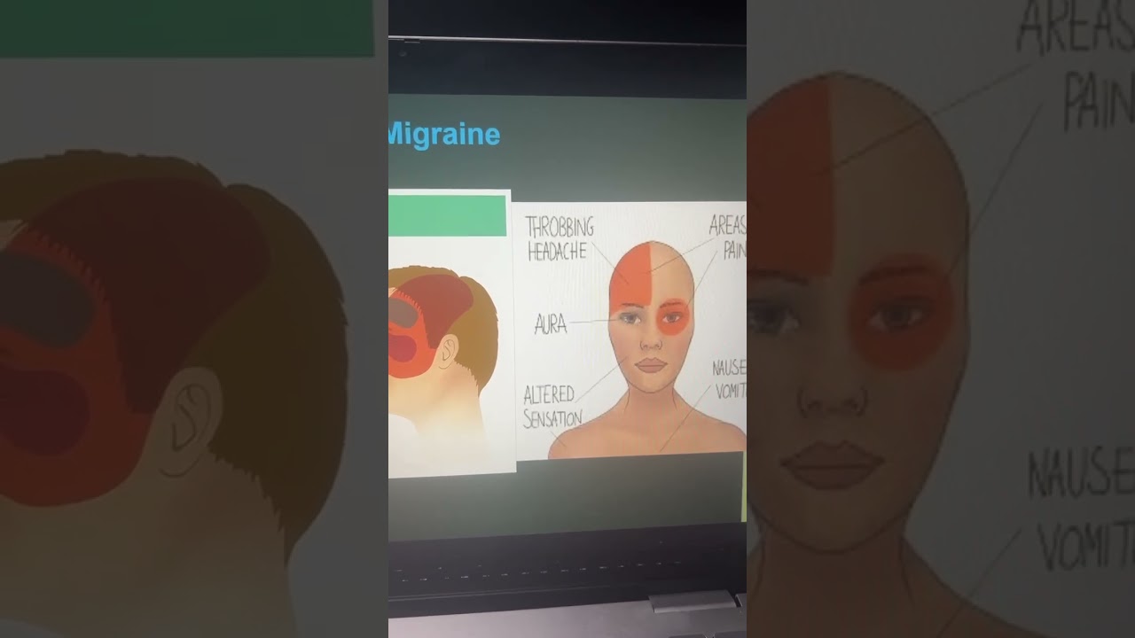 Do you have headaches? 