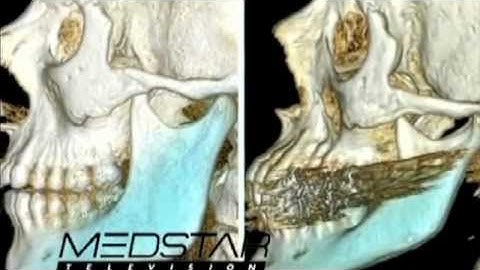 Doctor Robert Shaw Explains How Facial Bones Change as We Age