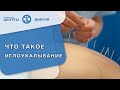 📍 Что такое иглоукалывание, какие к нему показания и противопоказания? Что такое иглоукалывание. 18+