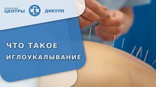 📍 Что такое иглоукалывание, какие к нему показания и противопоказания? Что такое иглоукалывание. 18+