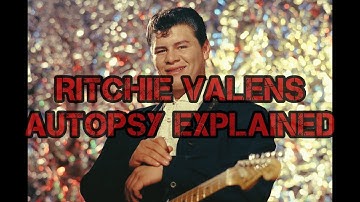 Famous Autopsies-Ritchie Valens Plane Crash