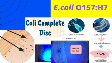 E.coli O157:H7 A Foodborne pathogen-Enrichment & Isolation|EEB,SMAC, TSYE,EMB and Coli complete Disc