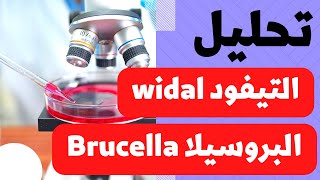 18_طريقة عمل تحليل التيفود(widal) والبروسيلا (brucella) بكل سهولة !!!! تم تحديث جودة الفيديو