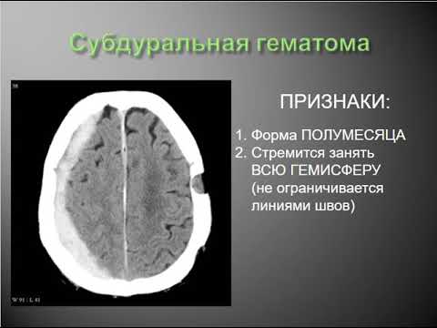 Видео: Текущее состояние твердотельного роста монокристаллов