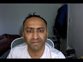 Accounting Policies Explained (Definition, Uses & Easy Examples)