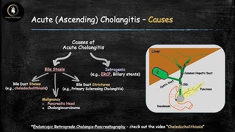 Acute Cholangitis