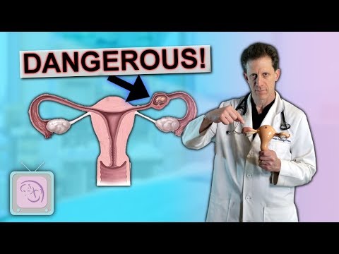 Video: How To Save A Pregnancy