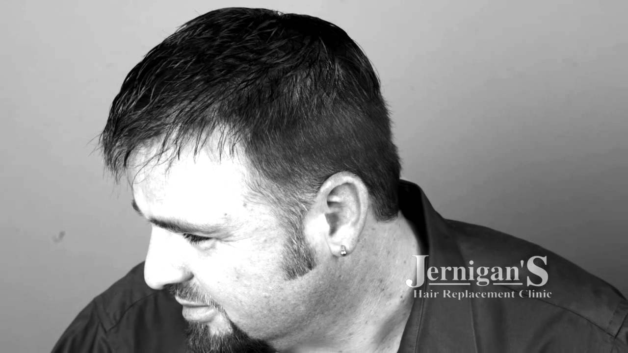 Jernigans Mens Hair Restoration Raleigh NC