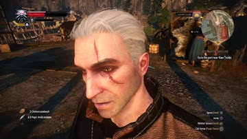 The Witcher 3 face glitch