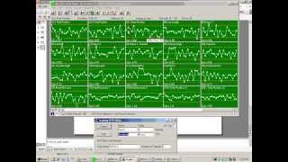 Prolink QC-CALC Real-Time