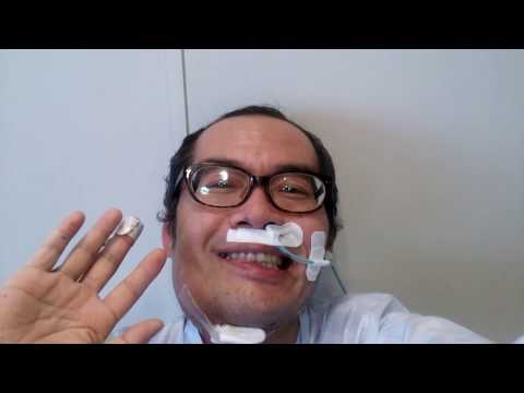 (舌がん･経過報告)飲食開始。