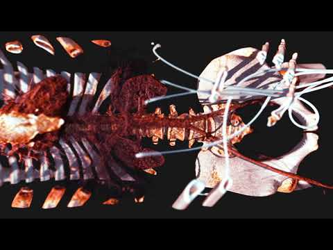 Volume rendering of chest - webgl - 4K 60fps, Depth of field