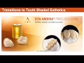 Esthetic Pressing Results Using a Revolutionary Zirconia Reinforced Lithium Disilicate Glass Ceramic