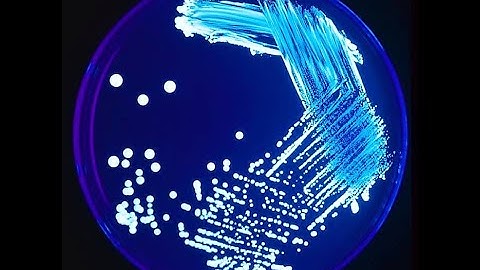 Lucknow University|| B.Sc. Biology(NEP) Sem-1|| Botany Practical File || Microbiology || Part-4