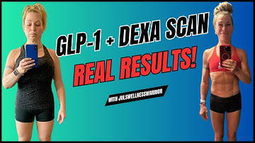 I Lost 50 Pounds… But What the DEXA Scan Found Surprised Me