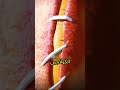 كيف تلتئم جروح الإنسان Shorts Shortvideo إنسان علوم صحة كيف تلتئم جروح الإنسان Shorts Shortvideo إنسان علوم صحة