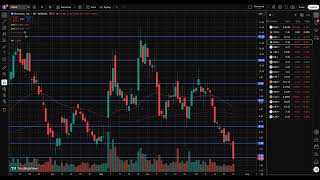 NVAX Stock (Novavax stock analysis) NVAX STOCK PREDICTION & analysis & news today
