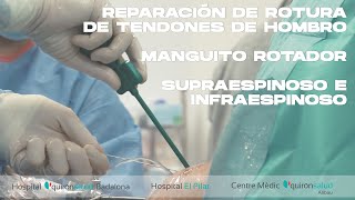 ROTURA DE SUPRAESPINOSO REPARACIÓN (Rotator cuff repair)