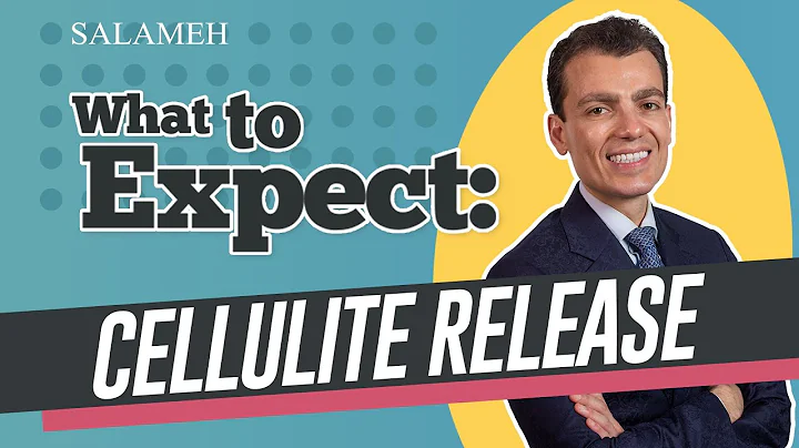 What To Expect: Cellulite Release | Salameh