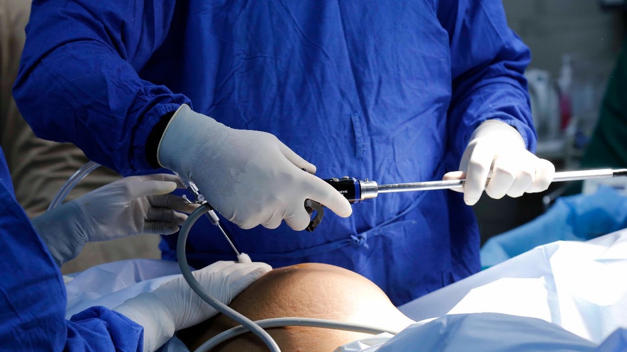 Live surgery Dr Modi Ovarian dermoid cystectomy YouTube