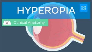 Farsightedness (Hyperopia): Definition, causes, symptoms, diagnosis and treatment | Kenhub