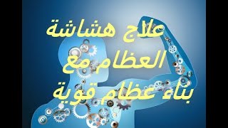 علاج هشاشة العظام مع بناء عظام قوية