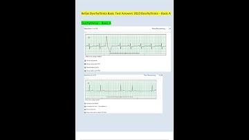 RELIAS DYSRHYTHMIA BASIC TEST ANSWERS 2023 DYSRHYTHMIA BASIC A QUESTIONS AND ANSWERS VERIFIED ANSWER