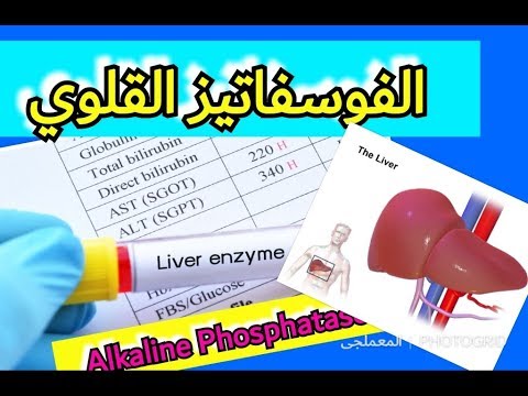 تحليل الفوسفاتيز القلوي . Alkaline Phosphatase