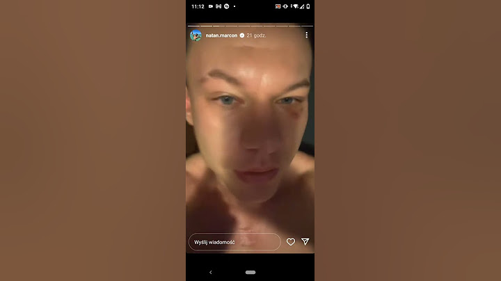 Natan Marcoń pokazuje oko po ataku hejtera