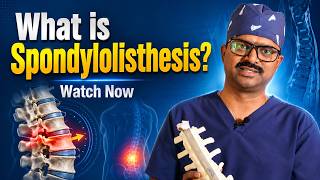 What Is Spondylolisthesis Symptoms Causes Treatment Explained Spine Care Dr Sukumar Sura