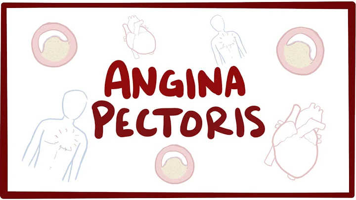 Angina pectoris (stable, unstable, prinzmetal, vasospastic) - symptoms & pathology - DayDayNews