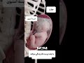کاملترین ویدیو از داخل شکم مادر باردار