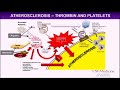 Combined Antiplatelets and Anticoagulants for Atherosclerosis: Insights from the COMPASS Study