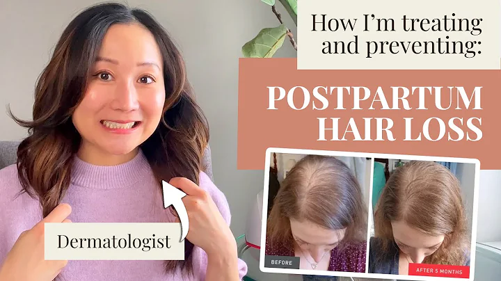 Dermatologist Tips for Postpartum Hair Loss Prevention and Treatments at Home! iRestore