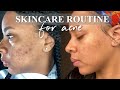 updated skincare routine + acne-prone skin | curology + more | jenise