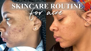 updated skincare routine + acne-prone skin | curology + more | jenise